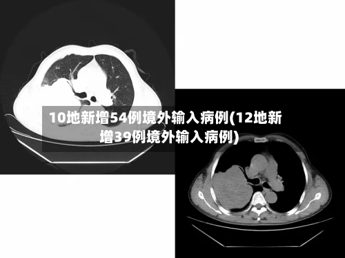 10地新增54例境外输入病例(12地新增39例境外输入病例)-第2张图片
